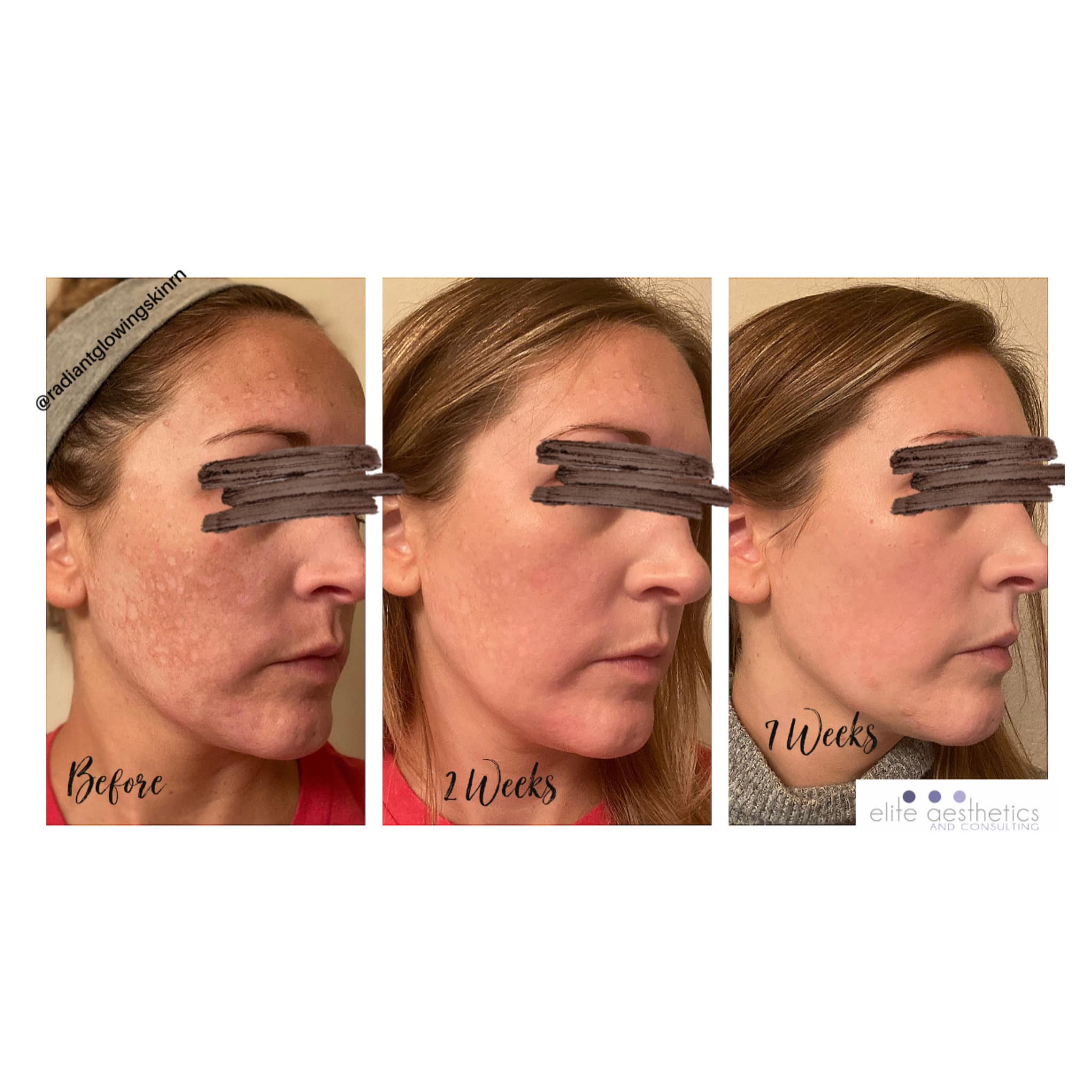 How does a medical spa differ from a day spa?